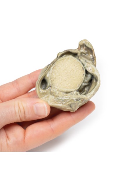 Idrocele - Erler Zimmer 3D anatomy Series MP2109