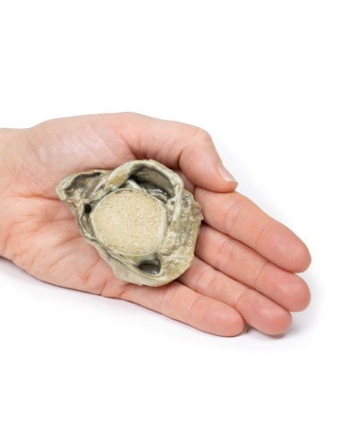 Hydrocele - Erler Zimmer 3D anatomy Series MP2109