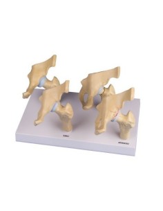 Erler Zimmer, anatomisches Modell der 4 Stadien der...