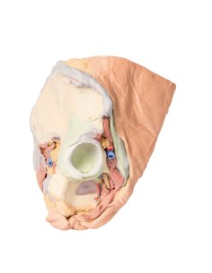 Female right pelvis: superficial and deep structures -...