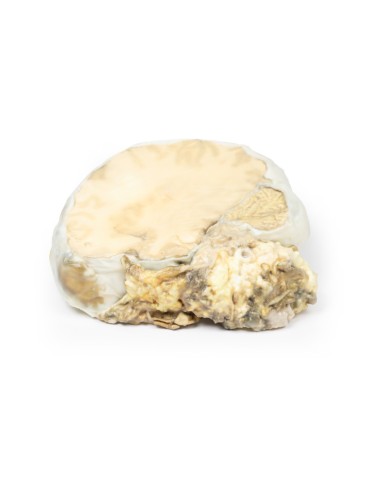 Adénome hypophysaire - Erler Zimmer 3D anatomy...