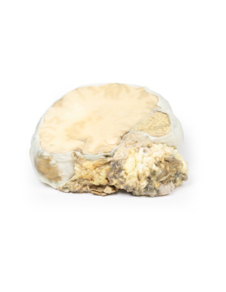 Hypophysenadenom - Erler Zimmer 3D-Anatomie Serie MP2006