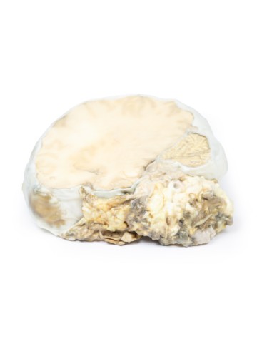 Adenoma hipofisario - Erler Zimmer 3D anatomy...