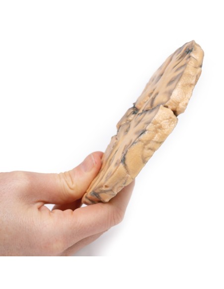 Astrocitoma - Erler Zimmer 3D anatomy Series MP2014