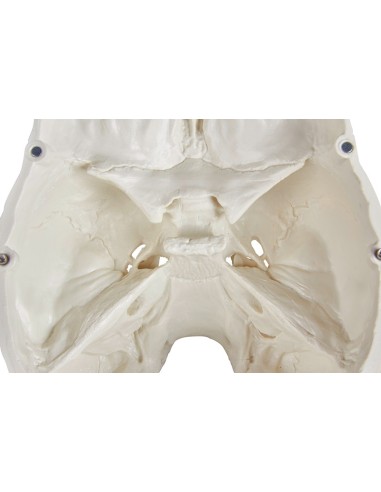 Erler Zimmer, Cranio, modello classico,...