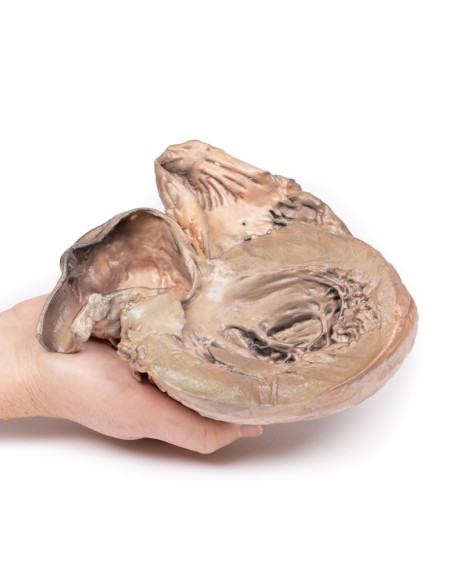 Rupturiertes thorakales Aortenaneurysma - Erler Zimmer 3D Anatomie Serie MP2043