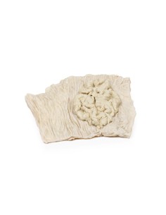 Villöses Adenom des Dickdarms - Erler Zimmer 3D anatomy...