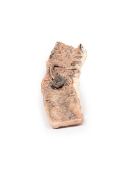 Adénome pédonculé du côlon - Erler Zimmer 3D anatomy Series MP2081