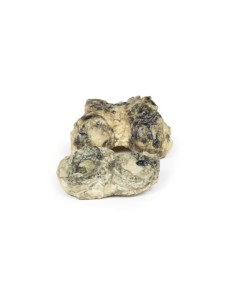 Artrite infettiva del ginocchio - Erler Zimmer 3D anatomy...