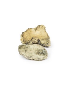 Infectious arthritis of the knee - Erler Zimmer 3D... 2