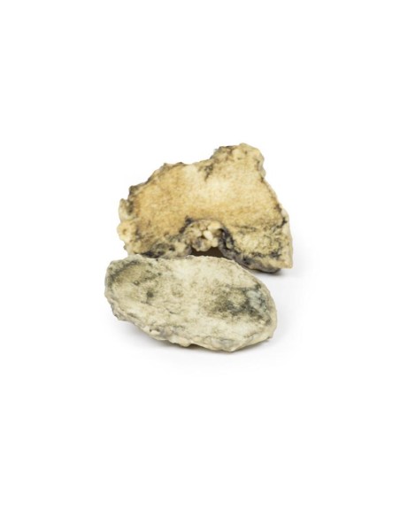 Infektiöse Arthritis des Knies - Erler Zimmer 3D Anatomie Serie MP2119