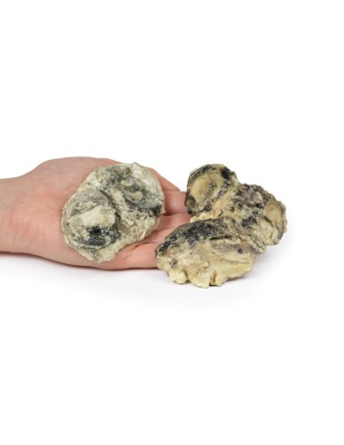 Arthrite infectieuse du genou - Erler Zimmer 3D...