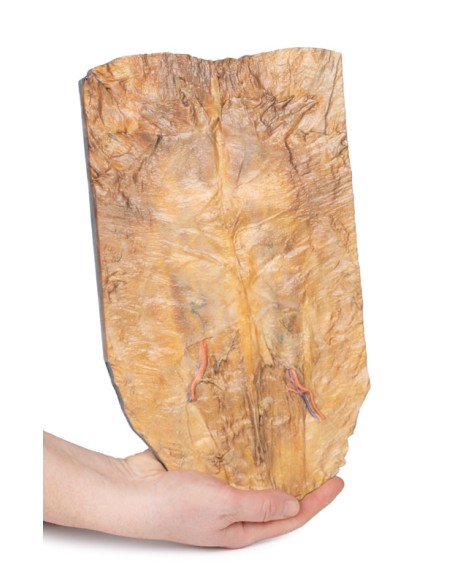 Pared abdominal interna - Erler Zimmer 3D anatomy Series MP1137