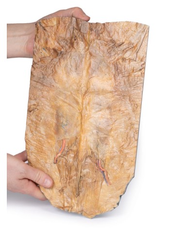 Pared abdominal interna - Erler Zimmer 3D...