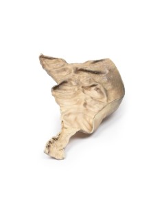 Hirschsprung's disease - Erler Zimmer 3D anatomy Series...