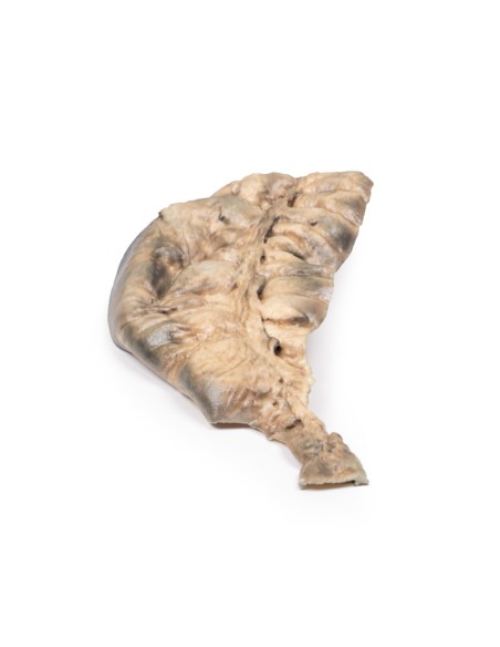 Maladie de Hirschsprung - Erler Zimmer 3D anatomy Series MP2079