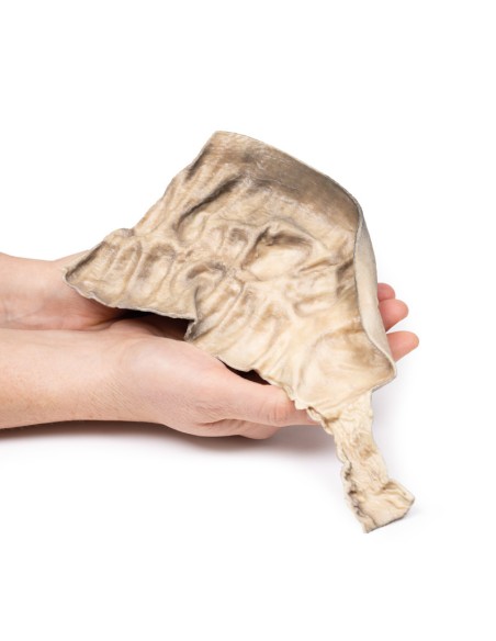 Enfermedad de Hirschsprung - Erler Zimmer 3D anatomy Series MP2079