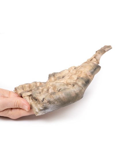 Enfermedad de Hirschsprung - Erler Zimmer 3D anatomy Series MP2079