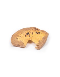 Métastases mésentériques d'un mélanome malin cutané -...