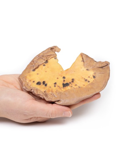 Metastasi mesenteriche da melanoma cutaneo maligno - Erler Zimmer 3D anatomy Series MP2083