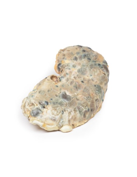 Polycystic kidney disease of the adult - Erler Zimmer 3D anatomy Series MP2091