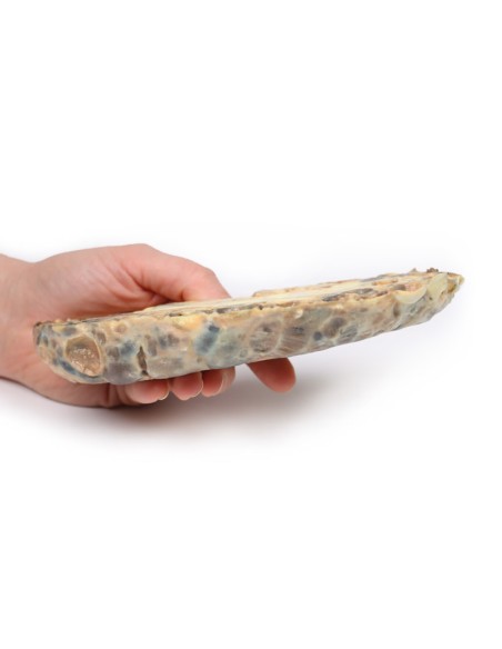 Polyzystische Nierenerkrankung bei Erwachsenen - Erler Zimmer 3D-Anatomie Serie MP2091