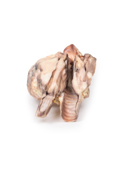 Schilddrüsenlymphom - Erler Zimmer 3D-Anatomie Serie MP2100