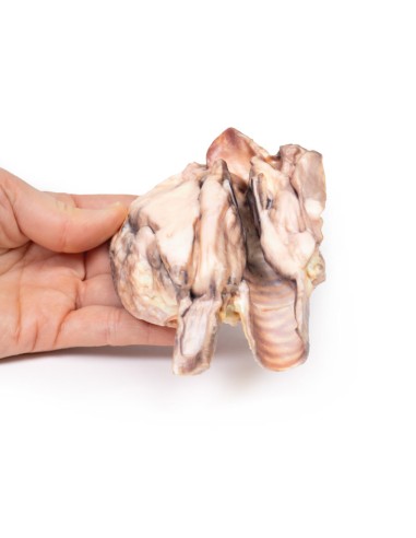 Linfoma tiroideo - Erler Zimmer 3D anatomy...