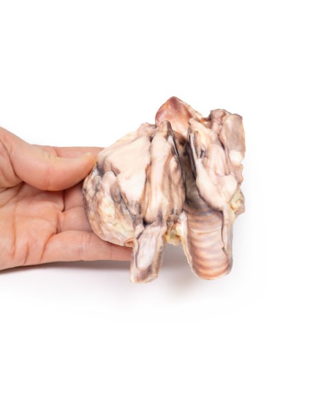 Linfoma tiroideo - Erler Zimmer 3D anatomy Series MP2100