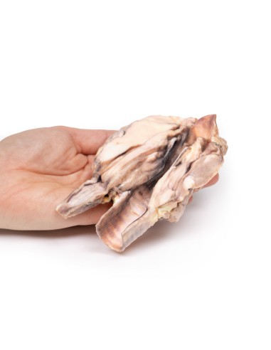 Schilddrüsenlymphom - Erler Zimmer 3D-Anatomie...