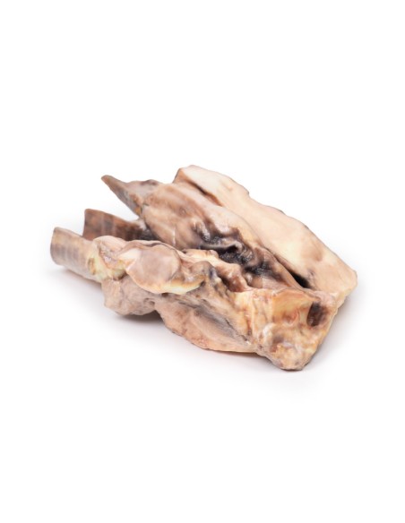 Linfoma della tiroide - Erler Zimmer 3D anatomy Series MP2100