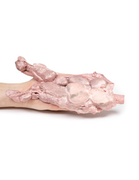 Aortic and para-aortic lymph nodes - Erler Zimmer 3D anatomy Series MP2103