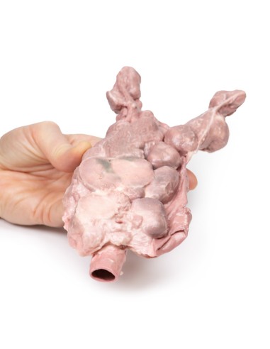 Aortic and para-aortic lymph nodes - Erler...