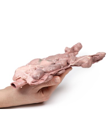 Linfonodi aortici e para-aortici - Erler Zimmer...