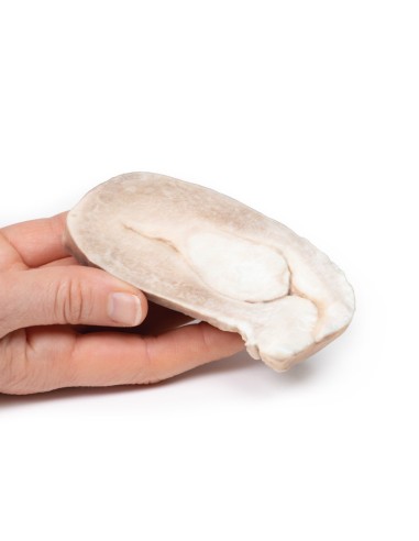 Uterine Leiomyoma - Erler Zimmer 3D anatomy...