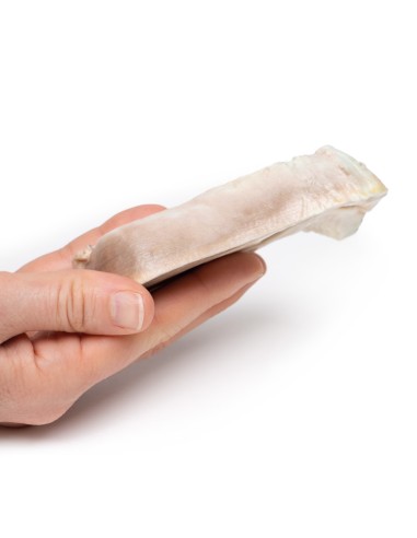 Uterine Leiomyoma - Erler Zimmer 3D anatomy...