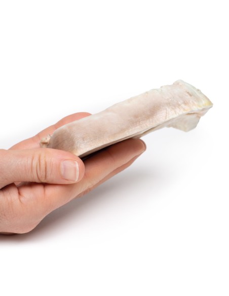 Uterine Leiomyoma - Erler Zimmer 3D anatomy Series MP2107