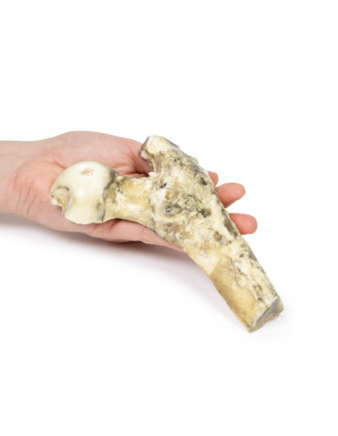 Metastasiertes malignes Melanom - Erler Zimmer...