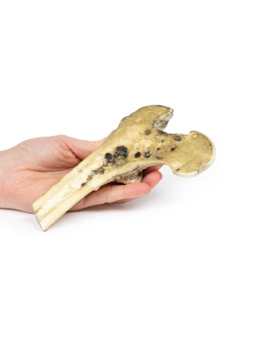 Melanoma maligno metastatico - Erler Zimmer 3D...