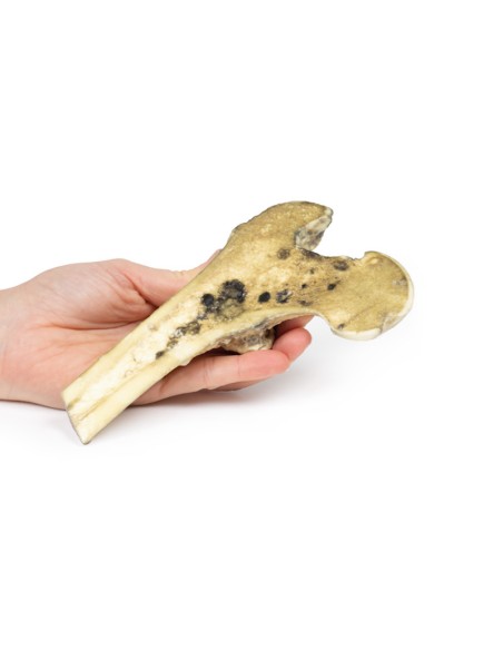 Metastasiertes malignes Melanom - Erler Zimmer 3D-Anatomie Serie MP2117