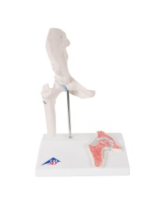 3B Scientific, A84/1 mini hip joint model with cross section 2
