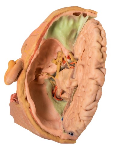 Dissezione di testa e collo - Erler Zimmer 3D...