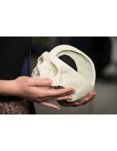 Skull with Brain Sickle - Erler Zimmer 3D...