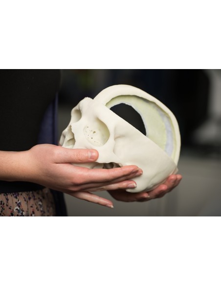 Skull with Brain Sickle - Erler Zimmer 3D anatomy Series MP1610