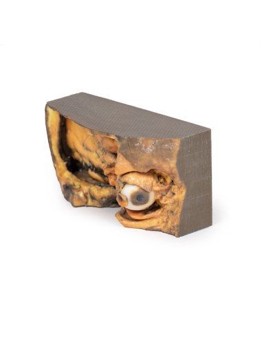 Orbita Laterale - Erler Zimmer 3D anatomy...