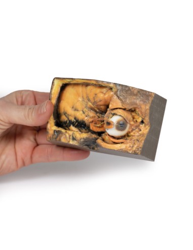 Seitlicher Orbit - Erler Zimmer 3D Anatomie...