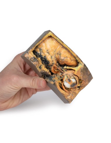 Orbita Laterale - Erler Zimmer 3D anatomy...