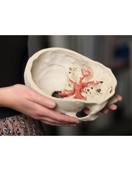 Poligono di Willis (circolo di Willis) - Erler Zimmer 3D anatomy Series MP1600