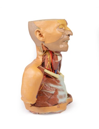 Cabeza, cuello y hombros con angiosomas - Erler...