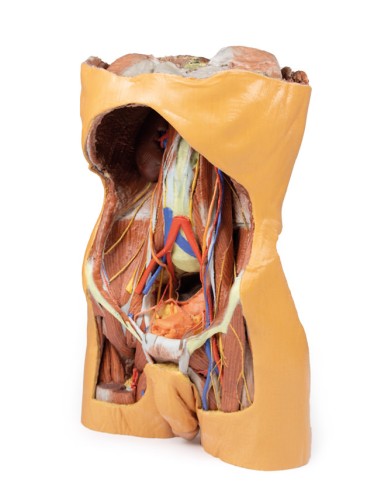 Pared abdominal posterior - Erler Zimmer 3D...